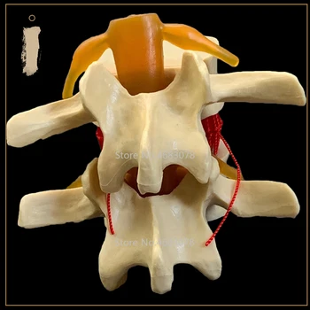1:1 Ľudskej anatómie kostra Chrbtice, Bedrových herniácie Disku Výučby Model lebky, mozgu traumatické pištole školy zdravotníckych pomôcok