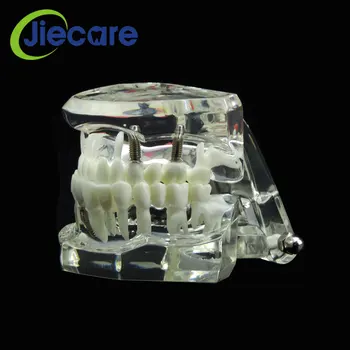 1 ks Hot Predaj Zubné Štúdia Zub Transparentné Dospelých Patologické Zuby Model Pre Zubné Dospelých učiteľské Študijné Zubár Materiálov