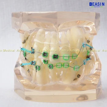 1 ks Orthodontists zuby model S kovové a keramické zátvorkách Orto Kovové zubár pacientovi vzdelávania študentov model Deasin