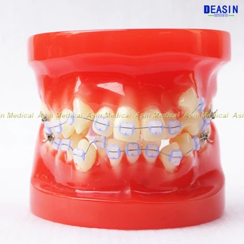 1 ks Orthodontists zuby model S kovové a keramické zátvorkách Orto Kovové zubár pacientovi vzdelávania študentov model Deasin