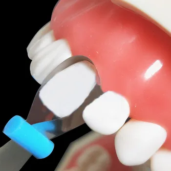 10pcs Zubné Twin Predný Matice Ortodontická Výkres Tvarované Kovové Polyester Zubár Matice Materiálu