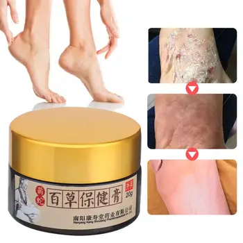 20 g Tradičná Čínska Nohy Zápach Liečba Krém Anti-Sušenie Crack Nohy Krém na Popraskané Päty Repair Cream Odstránenie Odumretých