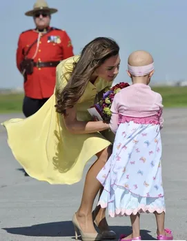 2018 Nové Žlté Pevné Princezná Kate Middleton Šifón Šaty Módne Tlačidlo Dizajn, Krátky Rukáv Skladaný Dresess 5080