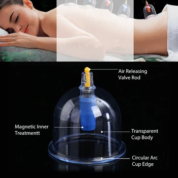 24Pcs Vákuové Massag Bankovanie Plechovky Sacie Čínskej Lekárskej Akupunktúra Acupoint Terapia Otvárač Vytiahnuť Reumatizmus Detoxikácie
