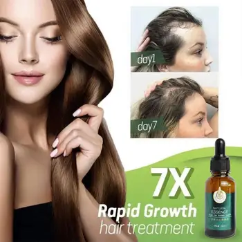 30ml 7X Rýchly Rast Vlasov Liečba Anti Hair Loss Rýchly Rast Vlasov Sérum Zázvor Esenciálny Olej Pre Pokročilých Rednutie Vlasov