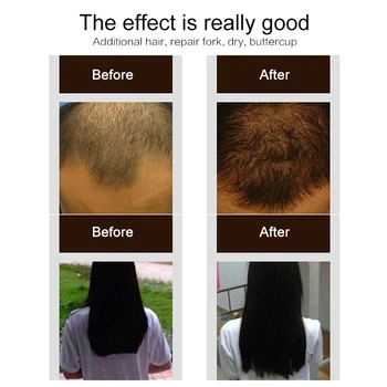 30ml Zázrak Rastu Vlasov Sprej Rýchlo Rásť 30 dní. Obnova Posilnenie Vlasov Liečba Anti Hair Loss Zabrániť Plešatosti TSLM2