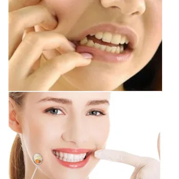 5 ks injekčných Striekačiek Zubné Remineralizáciu Zubov desensitizing Gél Znížiť Citlivosť Dať Minerálne Po Bielenie Zubov, Ošetrenie