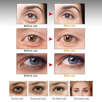 ARTISCARE Peptid Wrinkle Eye Sérum Proti Starnutiu, temný Kruh Hydratačné Anti-Opuchy Revitalizovať Fitness absorpciu Starostlivosť o Oči