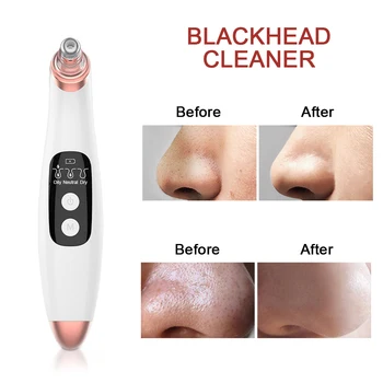Elektrické USB Blackhead Odstraňovač Sacie Akné Pórov Vysávač Black hlavu Odstránenie Starostlivosti o Pleť Nose Cleaner, S Skin Care Kit