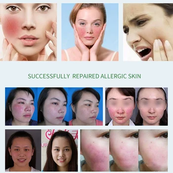 HEMEIEL PDT Opravy Pleťová Maska Anti-sensitive Upokojujúce Poškodenú Pokožku Hydratačné Fade Akné Jazva Starostlivosti o Pleť kórejský Kozmetika 3ks