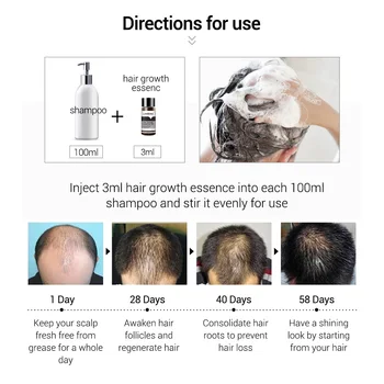 LANBENA Rast Vlasov Esenciálny Olej Oprava Vlasová Ošetrovateľskej Vlasových folikulov Výživný Posilňovanie Starostlivosti o Vlasy 20ml