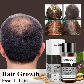 LANBENA Rast Vlasov Esenciálny Olej Oprava Vlasová Ošetrovateľskej Vlasových folikulov Výživný Posilňovanie Starostlivosti o Vlasy 20ml