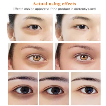 LANBENA Vitamín C Bielenie Očné Sérum Nikotínamid Oživiť Odstrániť Tmavé Kruhy Anti Opuchy Znížiť Pigmentácia Očný Krém