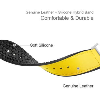 Originálne Kožené Hodinky Remienok Pre Fitbit Naopak 3 Smart Hodinky Oceľové Spony Band Náramok Pre Fitbit Zmysel Sledovať Accesssory
