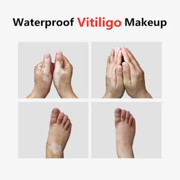 Pleť Vitiligo Pokrýva Korektor Vodeodolný make-up Pero dlhodobé Prírodné Tekuté Kryt na Tvár, Telo pre Ženy, Mužov, Vitiligo