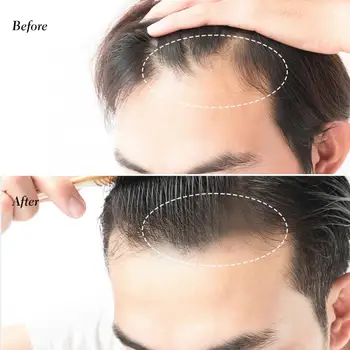 Starostlivosť o vlasy Sevich Vlasy Line Prášok Vlasová Tieň zakryť Prášok Vyplňte Rednutie Vlasov Krása Kozmetika Výrobok pre Starostlivosť o Vlasy