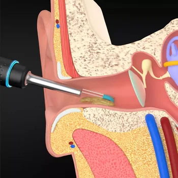XIAO MIJIA Inteligentné visual ucho trhanie rod 300W s vysokou presnosťou endoskop s 350mAH magnetické nabíjacej základni