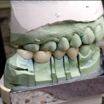 Zubné Laboratóriá Zirconia Blok A3 Zubné Laboratórium, Otvorená Cad Cam Frézovanie Wieland Systém Preshade 16 Farieb Zirconia Blok