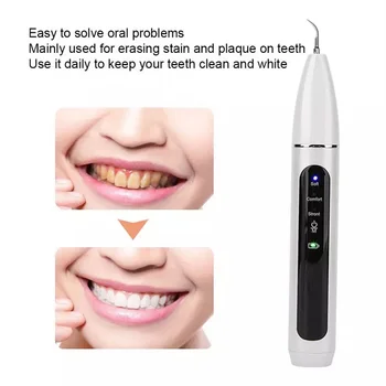 Úplné Lekárske Inteligentné Ultrazvukové Elektrické Zubné Scaler Prenosné Zubné Scaler Kalkul Škvrny Odstránenie Zubného Kameňa Cleaner Zubár