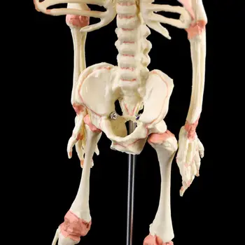 Ľudské Dieťa Deformovaný Hlava Lebka Výskumu Model Kostry Anatomické Mozgu Anatómie Výučby Displej